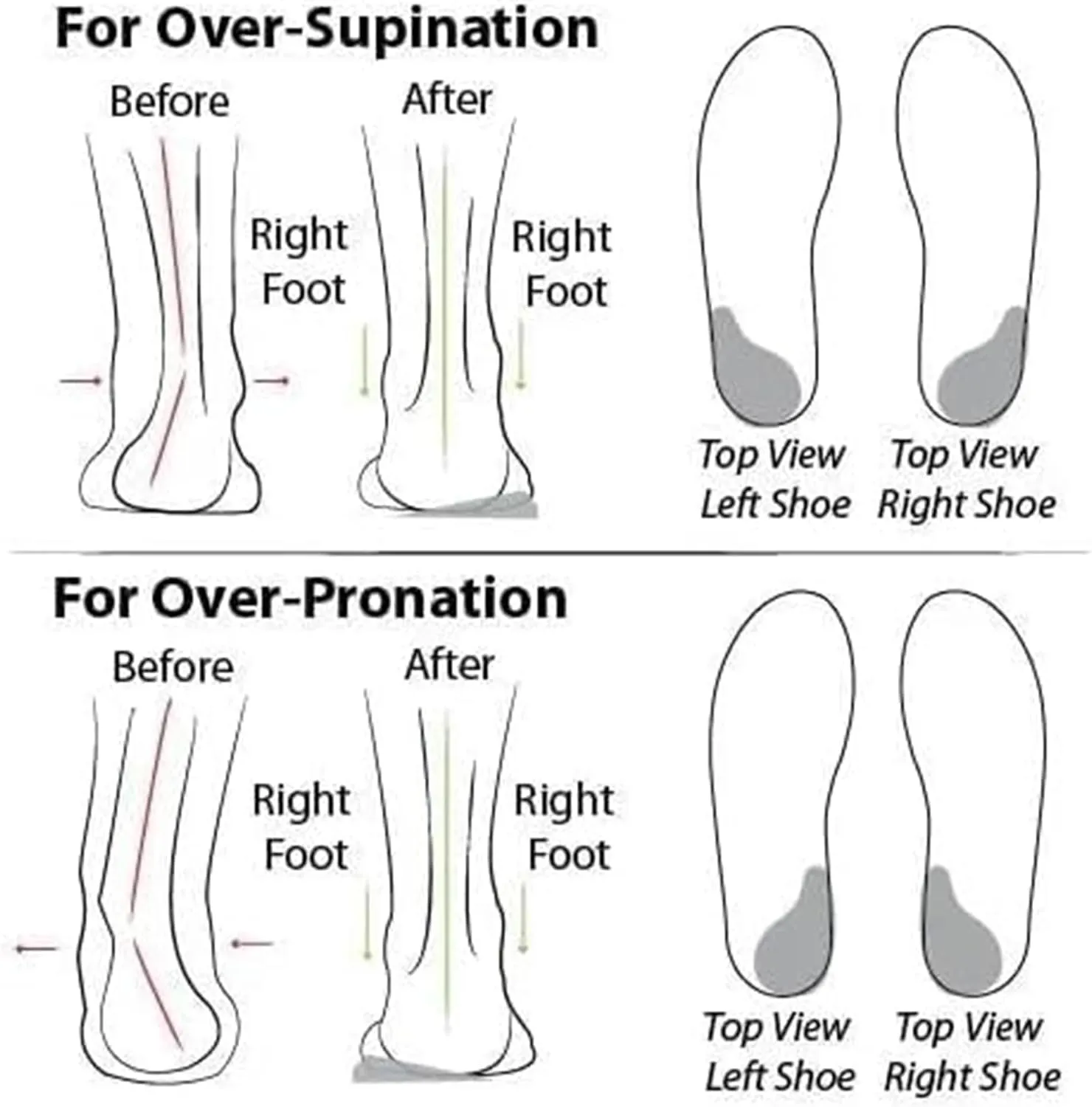Giltpeak Zapatos OrtopDicos para Mujer, New Women's Orthopedic Sneakers, Breathable Knitted Slip On Sneaker Working Casual Shoes,Diabetic Shoes for Women